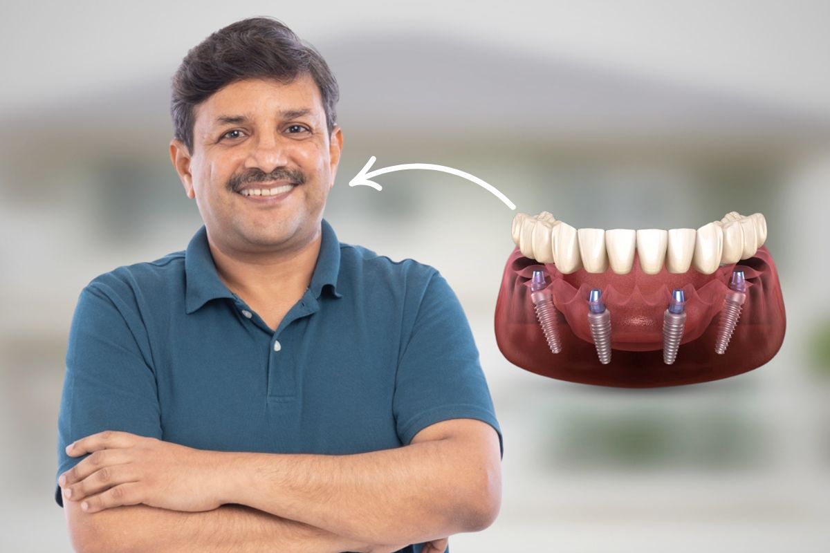 Full mouth rehabilitation in Wanjari Nagar