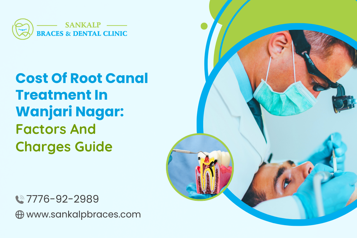 Cost of Root Canal Treatment in Wanjari Nagar: Factors and Charges Guide