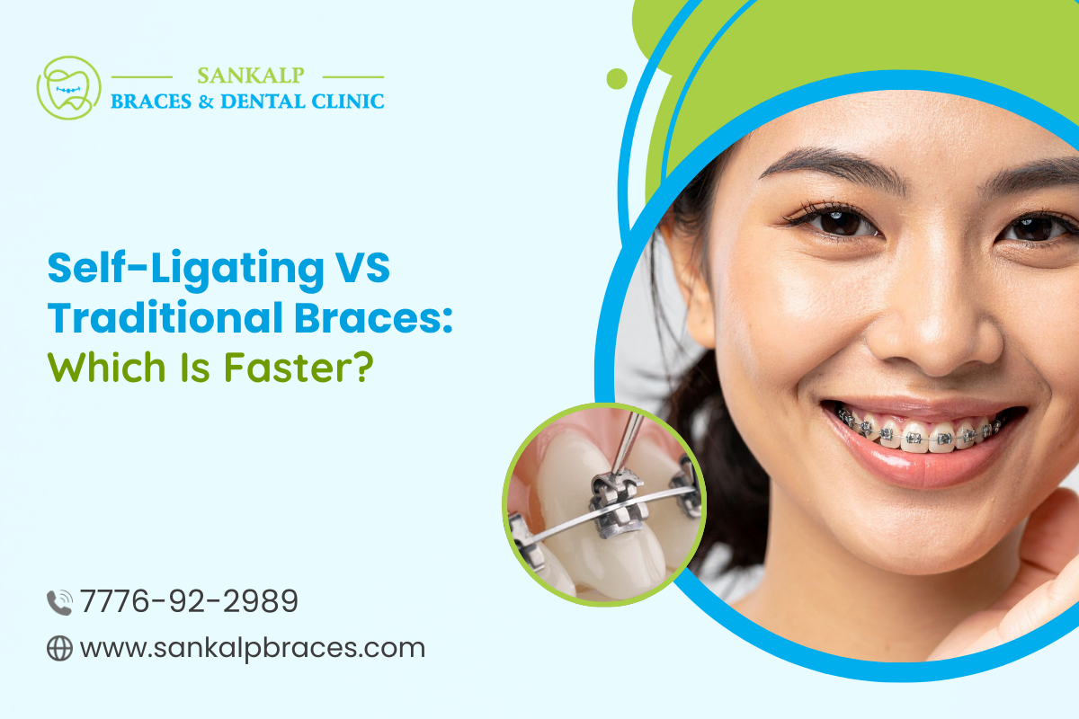 Self-Ligating vs Traditional Braces: Which Is Faster?