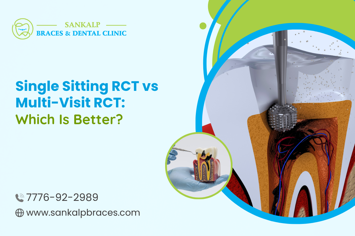 Single Sitting RCT vs Multi-Visit RCT: Which Is Better?
